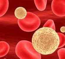 Niske leukociti u krvi: uzroci i liječenje