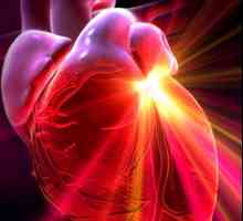 Srčanih mana: klasifikacijski