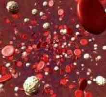 Povećan broj trombocita u krvi