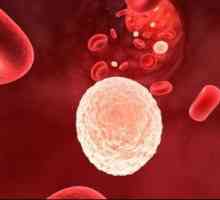 Povećana bijelih krvnih stanica u mokraći tijekom trudnoće