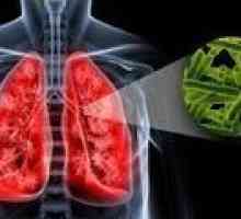 Uzroci plućne tuberkuloze