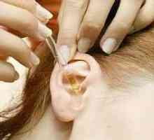 Bubuljica u uhu: Glavni uzroci i tretmani