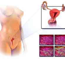 Rak vrata maternice: Znakovi i simptomi
