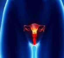 Vulvarnog raka kod žena - uzroci, dijagnoza, liječenje