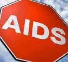 Razvoj AIDS povezan s prijenosom stanica-stanica HIV infekcije
