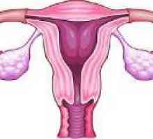 Zadržavanje Ciste jajnika - uzroci, simptomi, liječenje