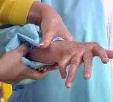 Reumatoidni artritis: obrada suvremenih i tradicionalnih metoda