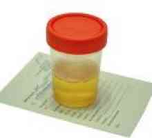 Šećer u urinu tijekom trudnoće, uzrocima, brzini