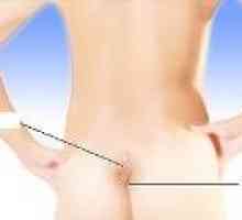 Bump na rep kost: uzroci, simptomi, liječenje