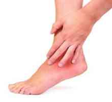 Simptomi i liječenje artritisa gležanj
