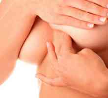 Simptomi i liječenje mastitisa u dojilja