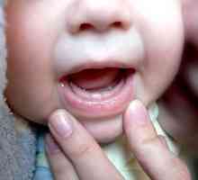 Simptomi zuba u djece