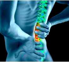 Simptomi stegnut živca u donjem dijelu leđa i liječenje
