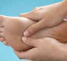 Dijabetes sindrom nogom u slikama: upoznajte simptome i tretmani