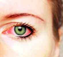 Metode za liječenje oka konjunktivitis