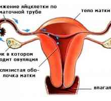 Stimulacija ovulacije