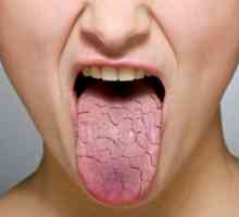 Suha usta - uzrokuje bolest