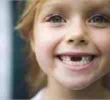 Dijete ne ispasti mliječne zube - uzroci