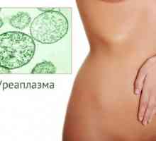 Ureaplasma u žena - Simptomi i liječenje