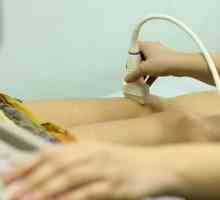Vaskularni ultrazvuk: što se događa i što vam je potrebno