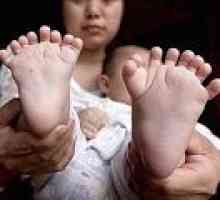 U Kini, dijete je rođen s 31 prsta