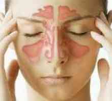 Upala sinusa: simptoma, liječenje