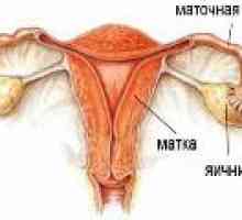 Upala jajnika - (oophoritis) u žena