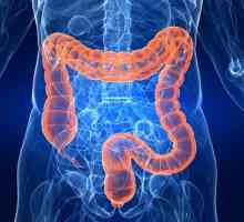 Upalna bolest crijeva: Simptomi i liječenje