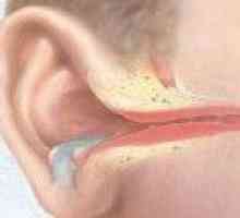 Upala srednjeg uha: uzroci, liječenje