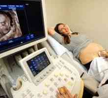 Štetno ako se ultrazvukom tijekom trudnoće? Koliko puta mogu učiniti?