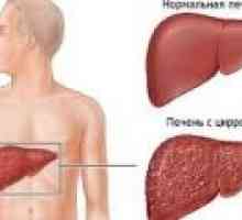 Bolesti jetre, znakovi i simptomi