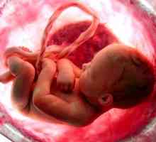 Propušteni pobačaj: Znakovi i simptomi