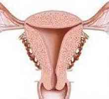 Žljezdane hiperplazija endometrija - uzroci, liječenje