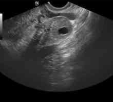 Žutom tijelu u jajniku tijekom trudnoće