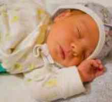 Žutica u novorođenčadi: uzroci, liječenje