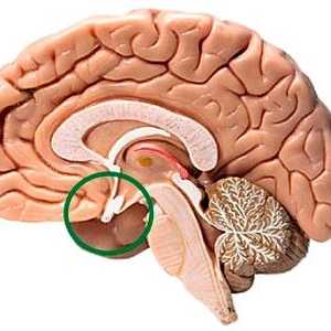 Adenom hipofize u mozgu