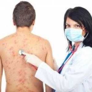 Alergični na kožu, alergijski osip na koži