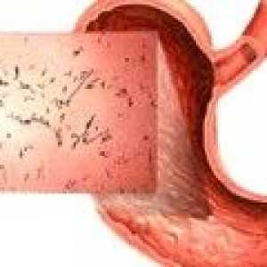 Amoebic dizenterija: simptoma, liječenje