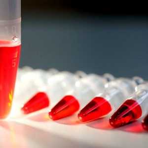 Krvni testovi za hormone štitnjače
