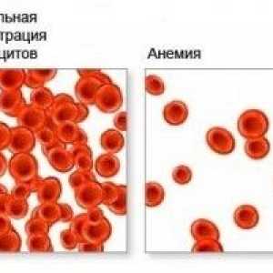 Anemija krvi, što je rezultiralo u anemija, krv?