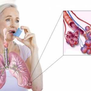 Astma: Simptomi i liječenje