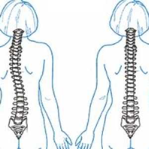 Što će kiropraktičar za bolove u leđima?