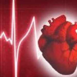 Što je nenormalan srčani ritam?