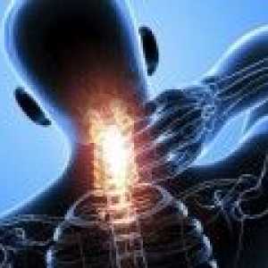 Što je artroza unkovertebralny?