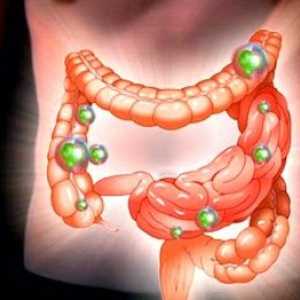 Crijevne dysbiosis: simptomi i tretman kod odraslih