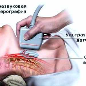 Doppler sonografija (ultrazvuk) istraživanja žilama mozga i vrata