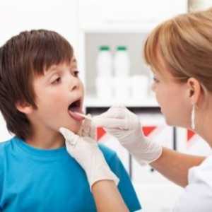 Faringitis u djece - Simptomi i liječenje faringitisa djeteta