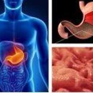 Gastritis s niskim kiselosti: Simptomi i liječenje
