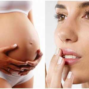 Herpes na usnama tijekom trudnoće