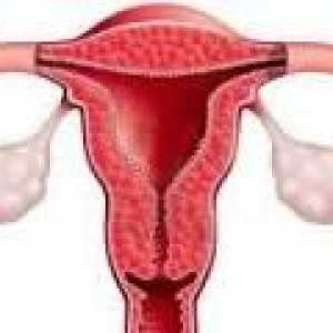 Hiperplazija endometrija nakon kiretaže